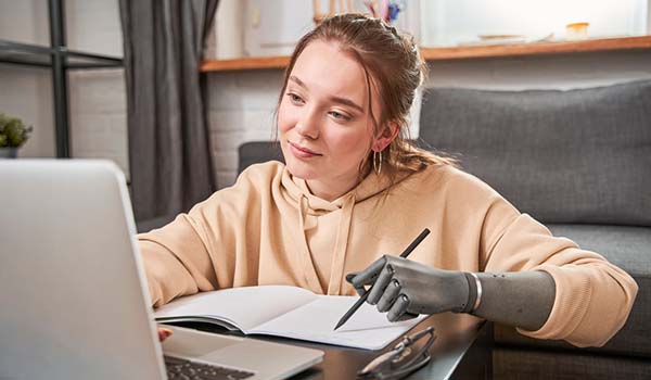 successful young female using a computer who has a metal prosthetic arm
